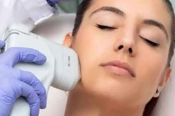 Image of woman having HIFU Harrogate treatment