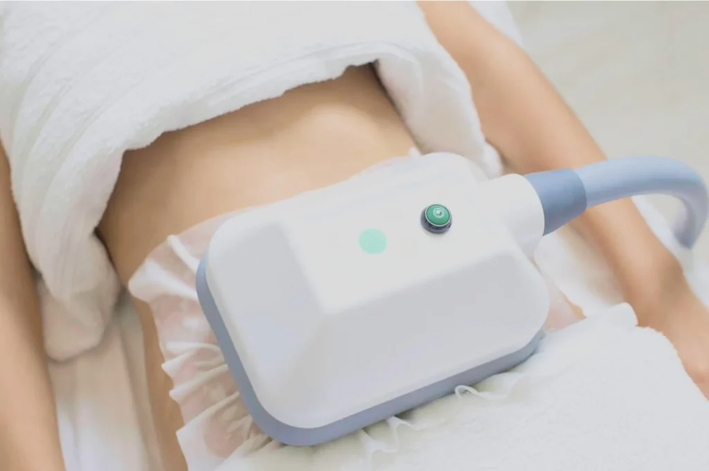 How Fat Freezing and HIFU Work Together? 3 advantages to combining Fat Freezing and HIFU Harrogate