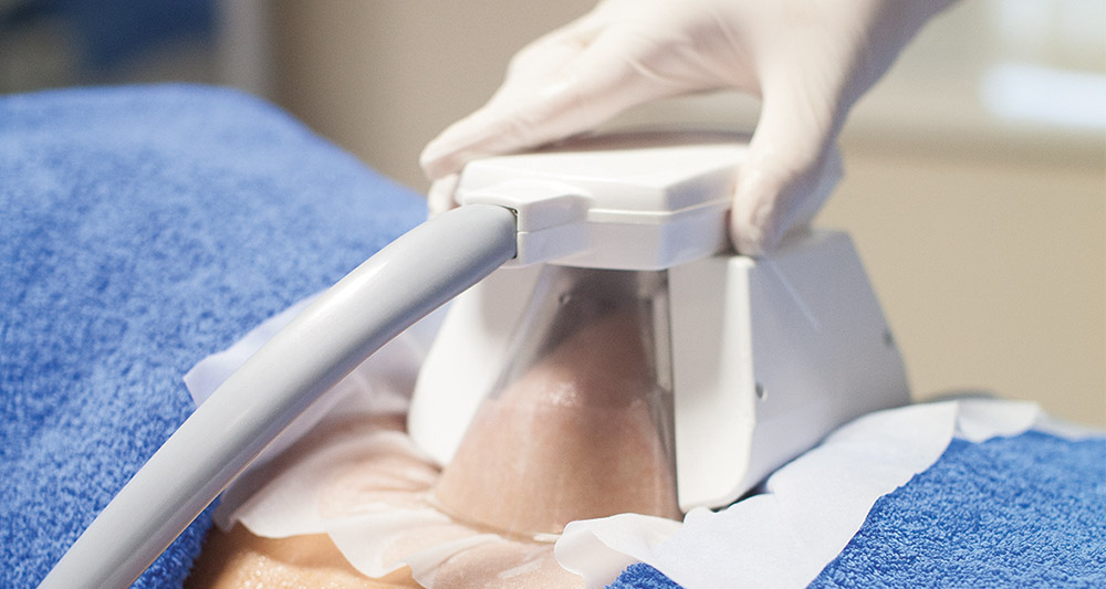 How Fat Freezing and HIFU Work Together? 2 Multiple Areas in One Session HIFU and Fat Freezing Harrogate
