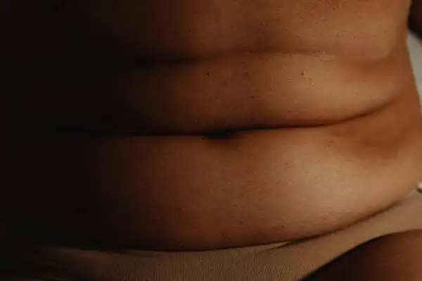 The Hidden Connection: How Stress Shapes Your Fitness and Body Composition 3 image of what stress can do on the stomach area and how Lipo 360 Harrogate can help to change your body shape.