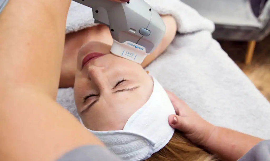 Discover the Perfect Duo: RF Microneedling and HIFU 1 Image of Morpheus8 And HIFU Harrogate combined treatment
